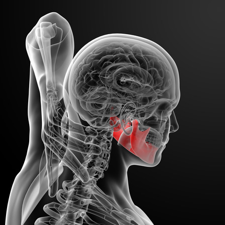 Verspannungen im Kiefergelenk können zu Nackenschmerzen, Tinitus, Kopfschmerzen und Schwindel führen 